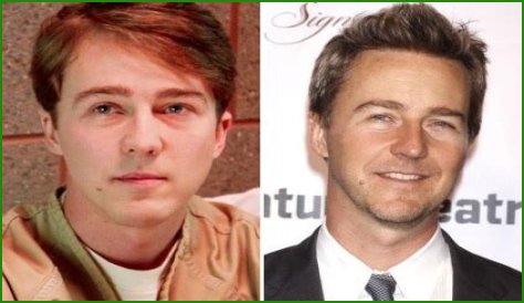 Edward Norton Plastic Surgery Before and After